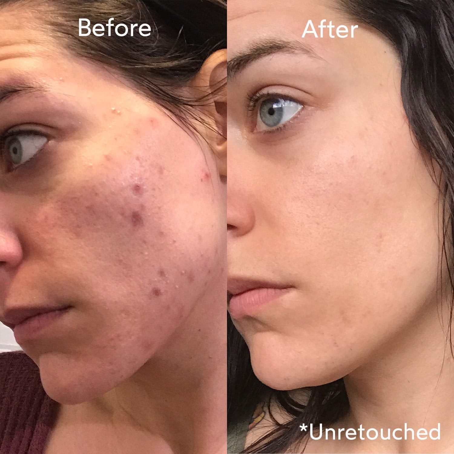 Dr. Clinic's Magic Blend for Dark Spots, Whitening